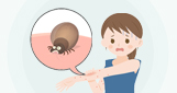 쯔쯔가무시증
