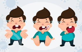 수족구병