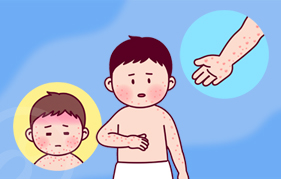 풍진