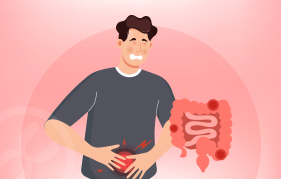 대장암