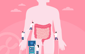 과민성 장증후군